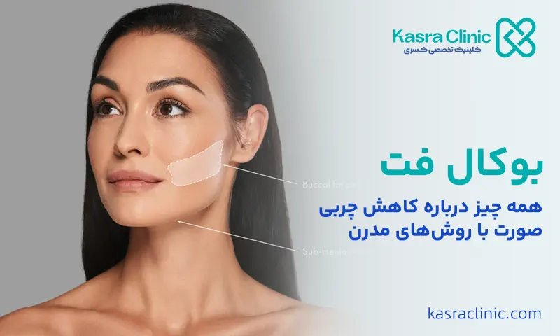 بوکال فت در ملارد