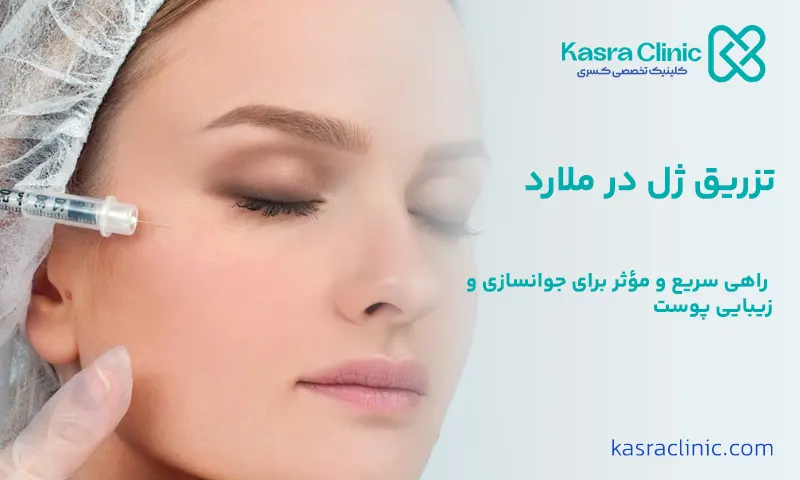 تزریق ژل در ملارد